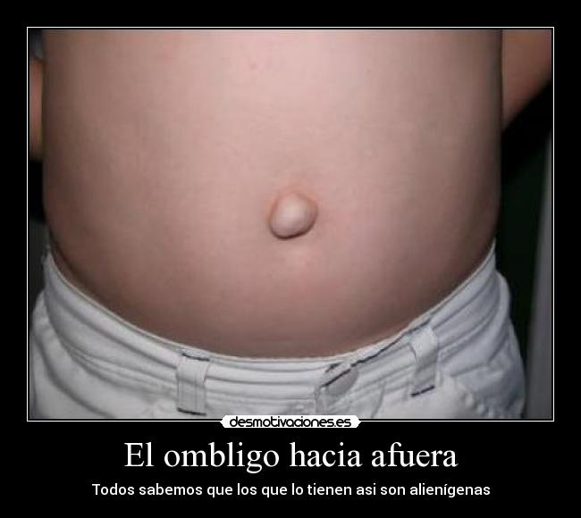 El ombligo hacia afuera -