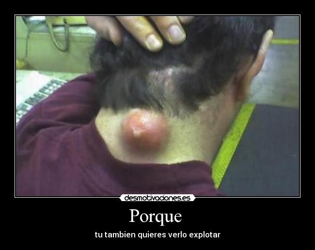 Porque - tu tambien quieres verlo explotar