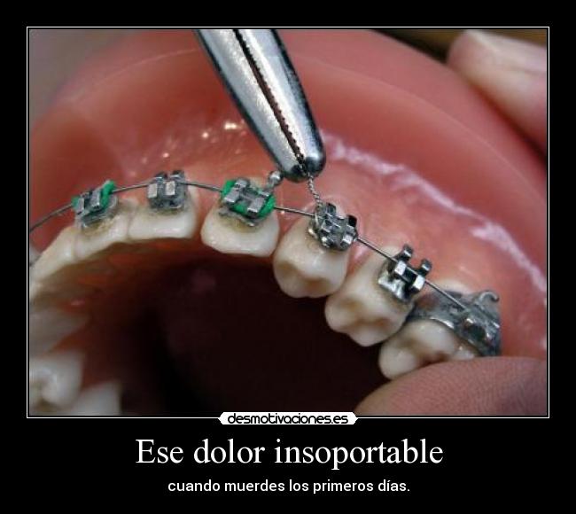 Ese dolor insoportable - 