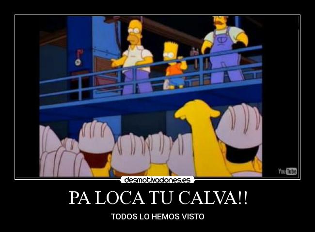 PA LOCA TU CALVA!! - TODOS LO HEMOS VISTO