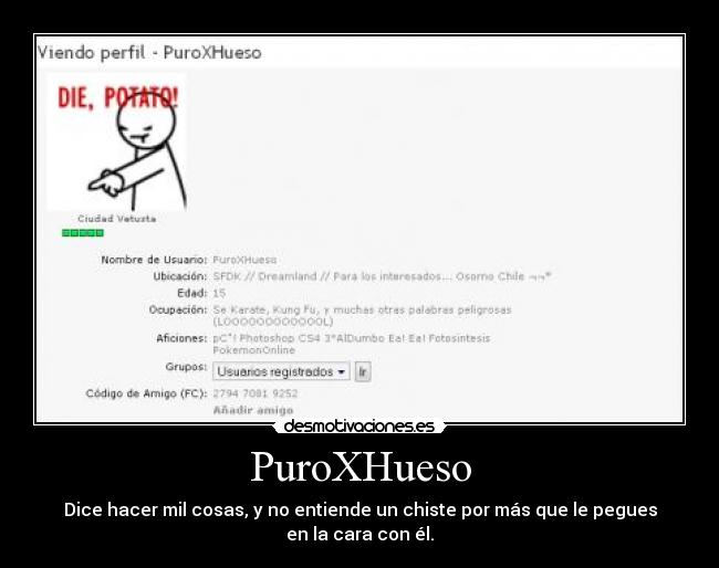 PuroXHueso - Dice hacer mil cosas, y no entiende un chiste por más que le pegues en la cara con él.