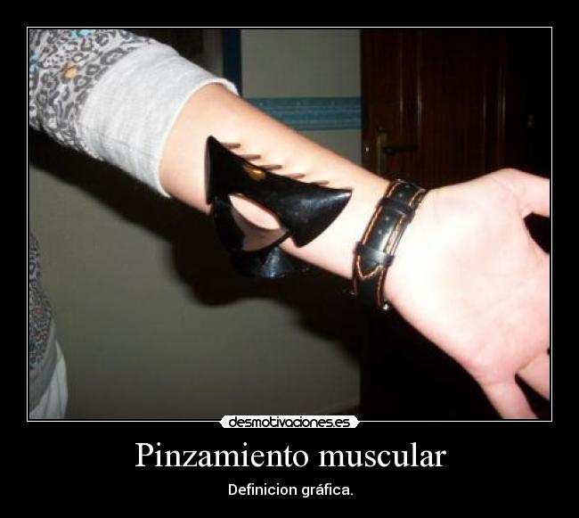 Pinzamiento muscular -