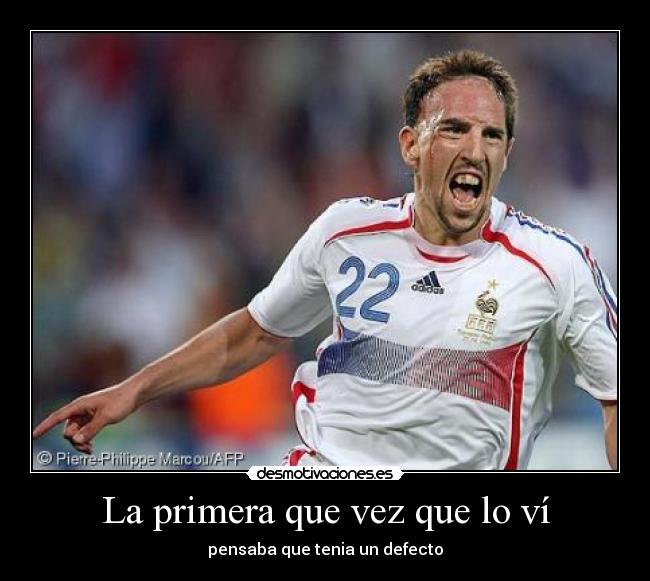 La primera que vez que lo ví - pensaba que tenia un defecto
