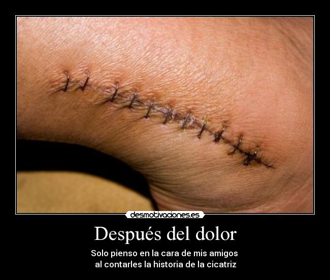 Después del dolor - Solo pienso en la cara de mis amigos
al contarles la historia de la cicatriz