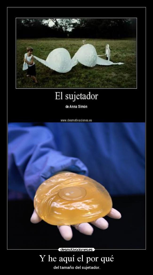 Y he aquí el por qué -