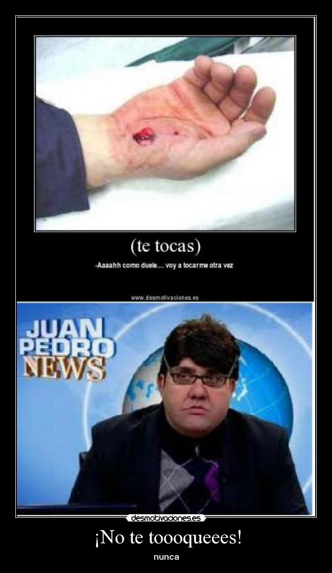 carteles nuca desmotivaciones