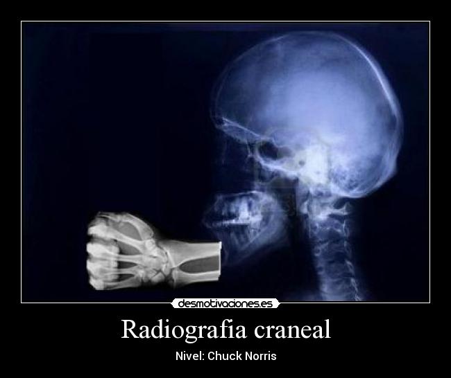 Radiografia craneal - Nivel: Chuck Norris