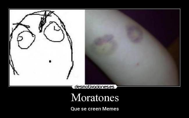 Moratones - 