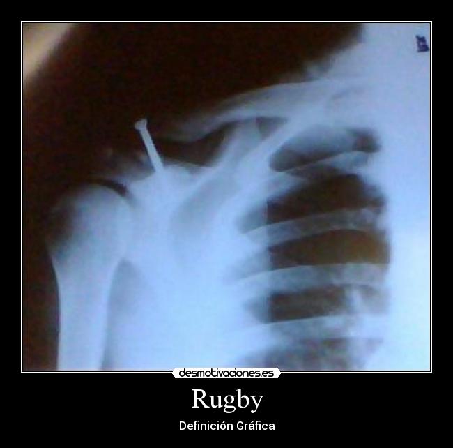 Rugby - Definición Gráfica