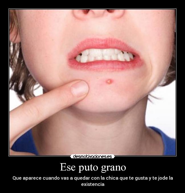 Ese puto grano - Que aparece cuando vas a quedar con la chica que te gusta y te jode la existencia