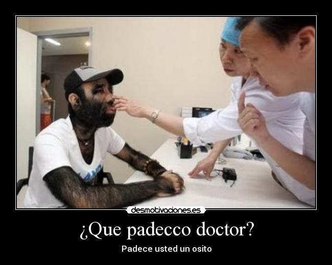 ¿Que padecco doctor? - Padece usted un osito