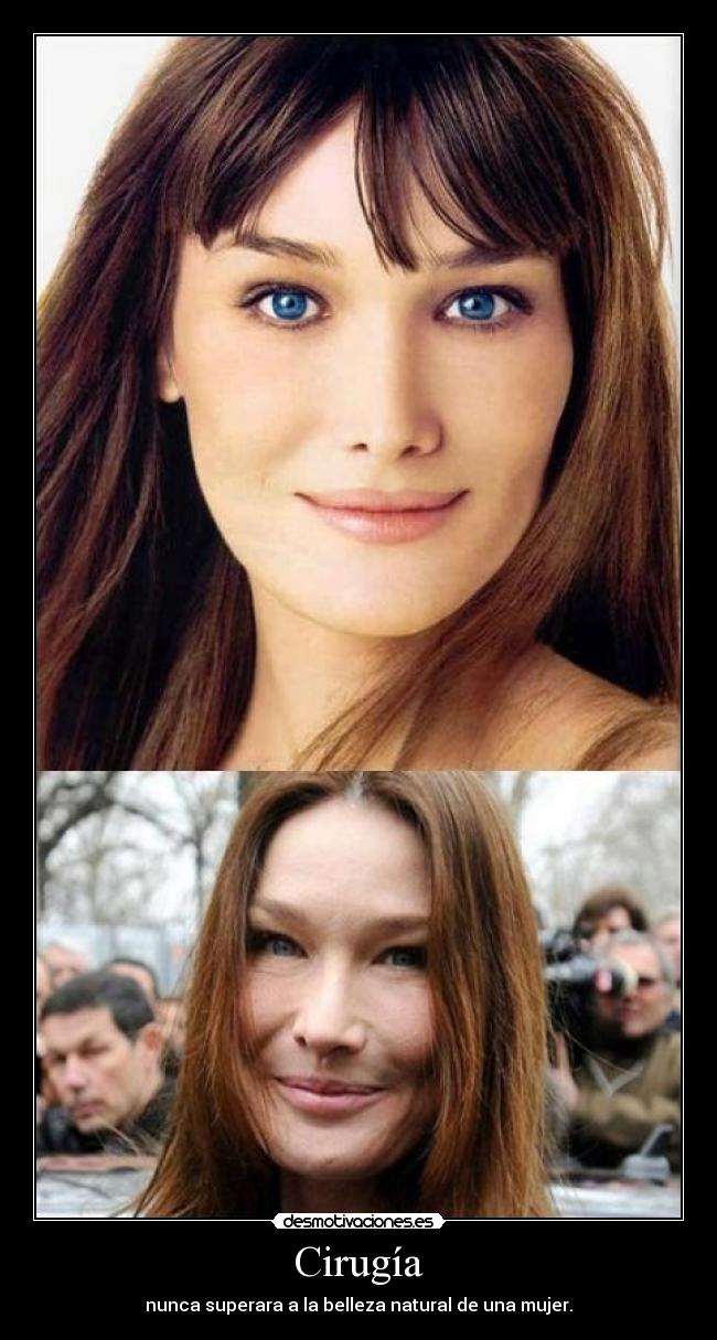 Cirugía - nunca superara a la belleza natural de una mujer.