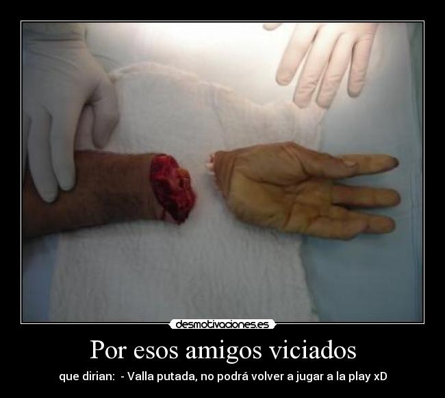 Por esos amigos viciados -