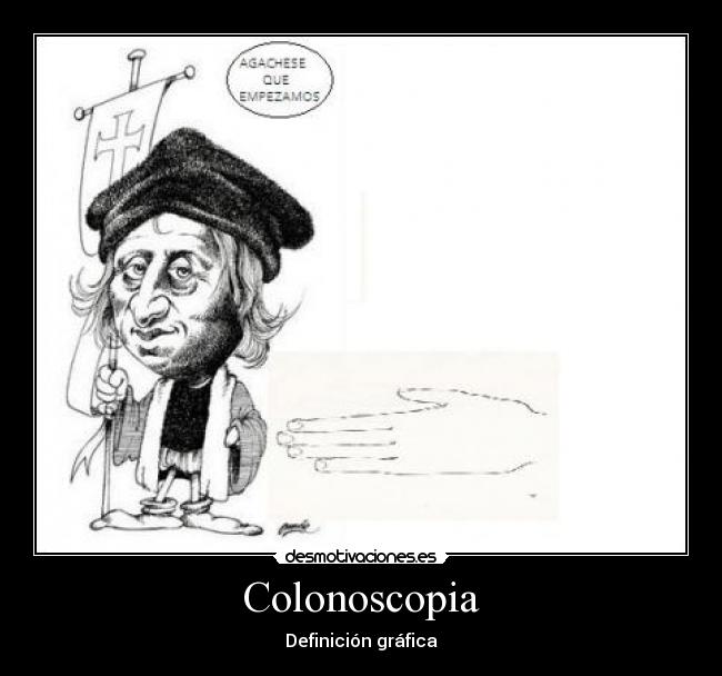 Colonoscopia - Definición gráfica