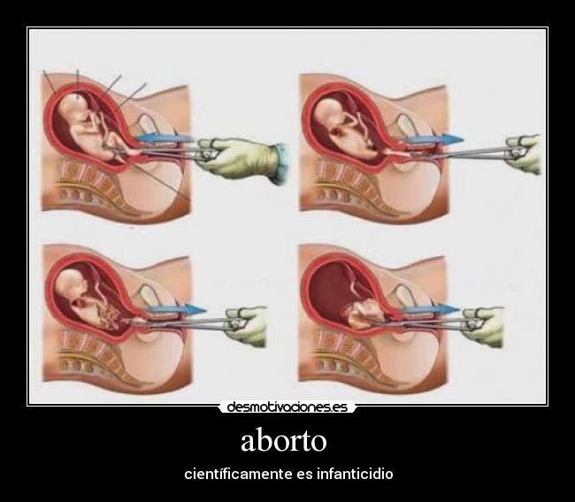 aborto - científicamente es infanticidio