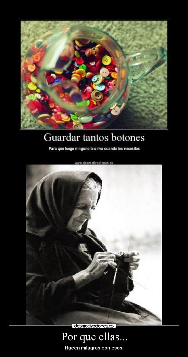 Por que ellas... - Hacen milagros con esos.