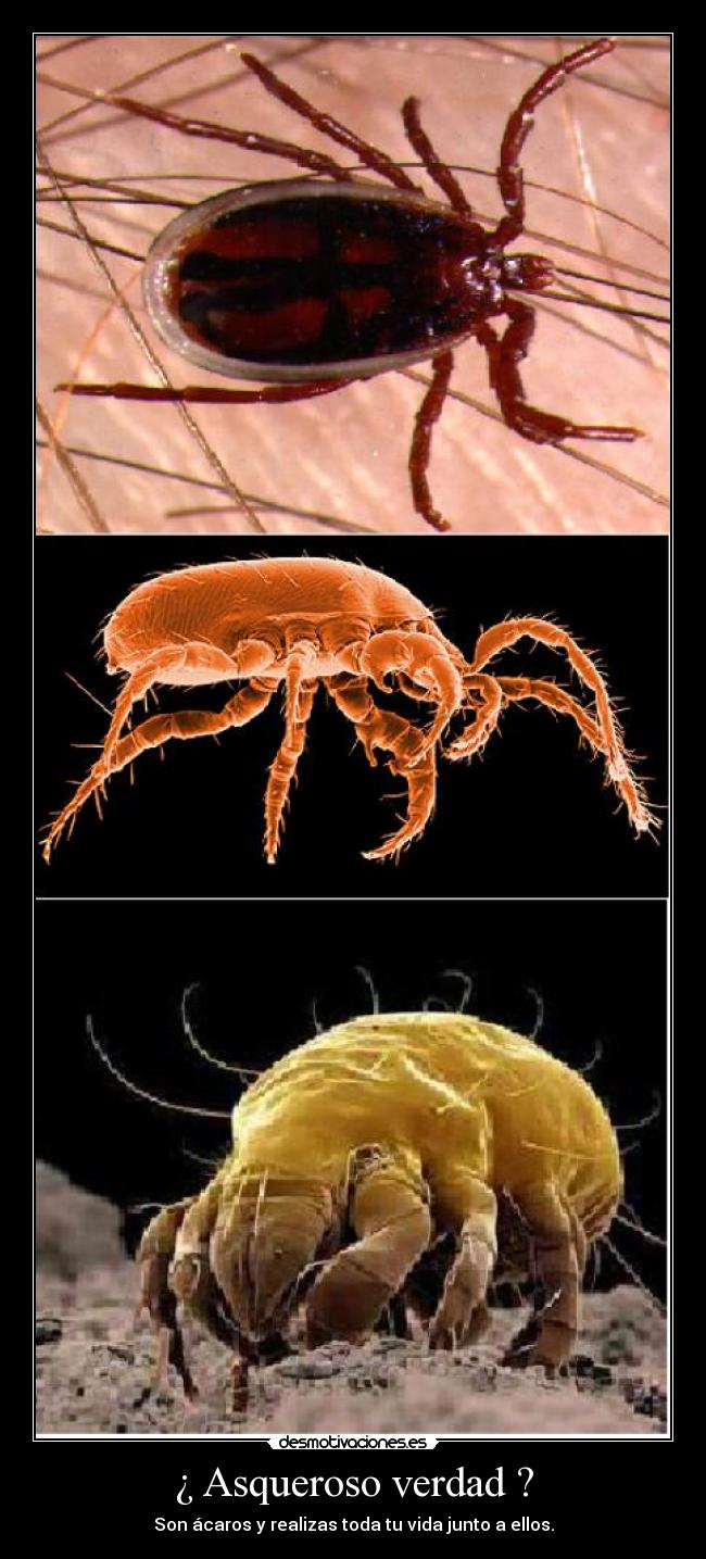 ¿ Asqueroso verdad ? - Son ácaros y realizas toda tu vida junto a ellos.