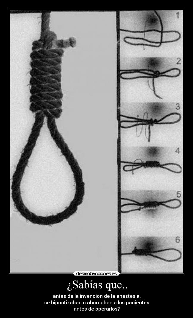 ¿Sabías que.. - antes de la invencion de la anestesia,
se hipnotizaban o ahorcaban a los pacientes
antes de operarlos?