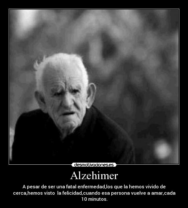 Alzehimer - 