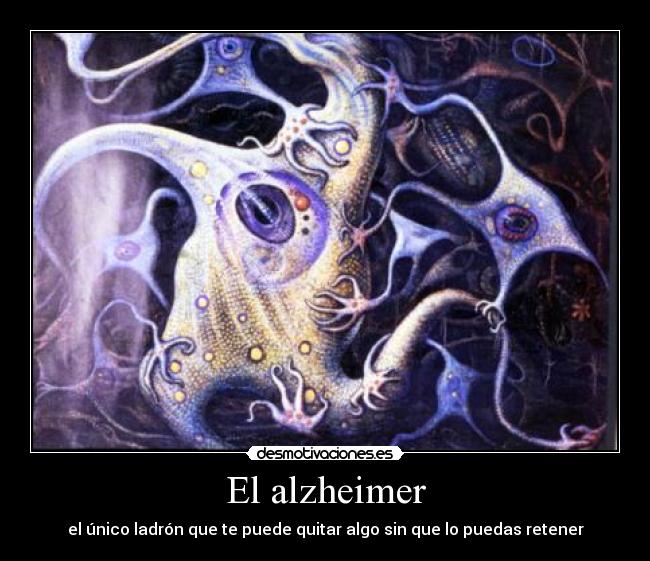 El alzheimer -