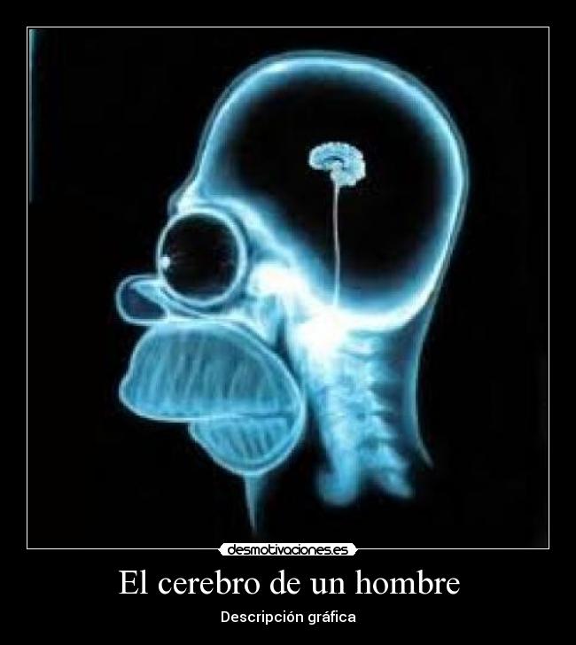 El cerebro de un hombre -