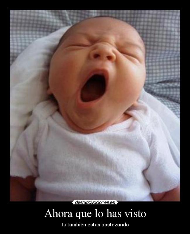 Ahora que lo has visto - 