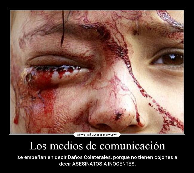 Los medios de comunicación - se empeñan en decir Daños Colaterales, porque no tienen cojones a
decir ASESINATOS A INOCENTES.