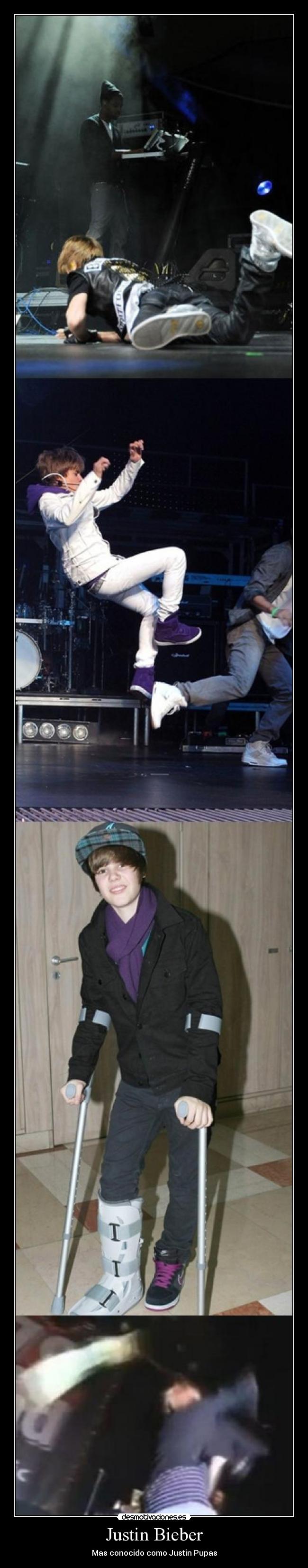 Justin Bieber - Mas conocido como Justin Pupas