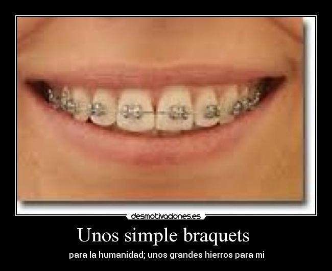 Unos simple braquets -