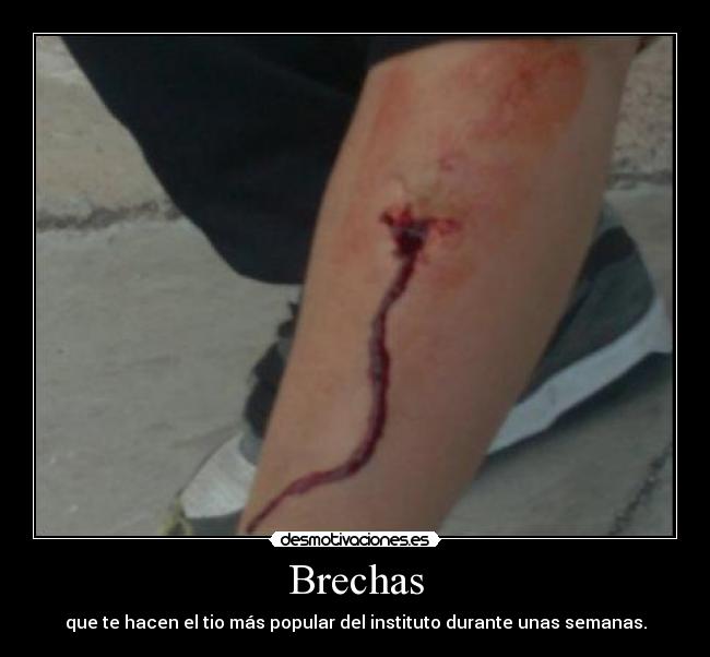 Brechas - que te hacen el tio más popular del instituto durante unas semanas.