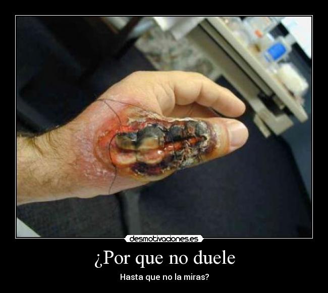 ¿Por que no duele - Hasta que no la miras?