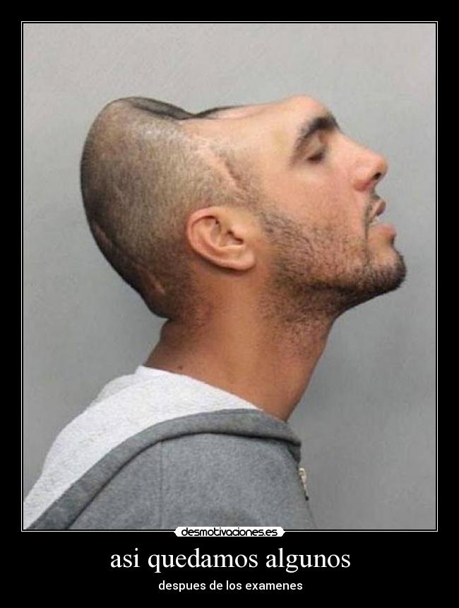 asi quedamos algunos - 