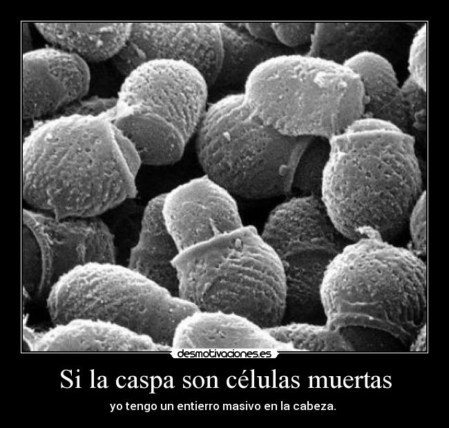 Si la caspa son células muertas - yo tengo un entierro masivo en la cabeza.