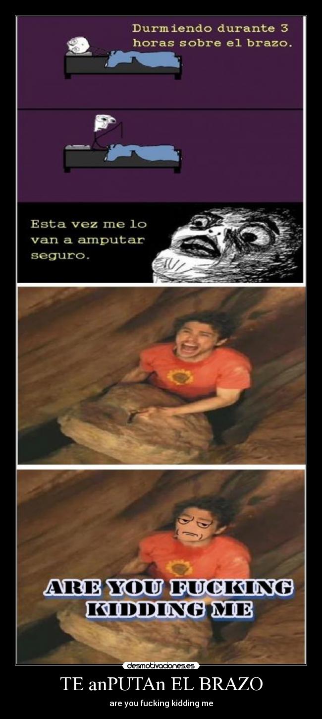 TE anPUTAn EL BRAZO -