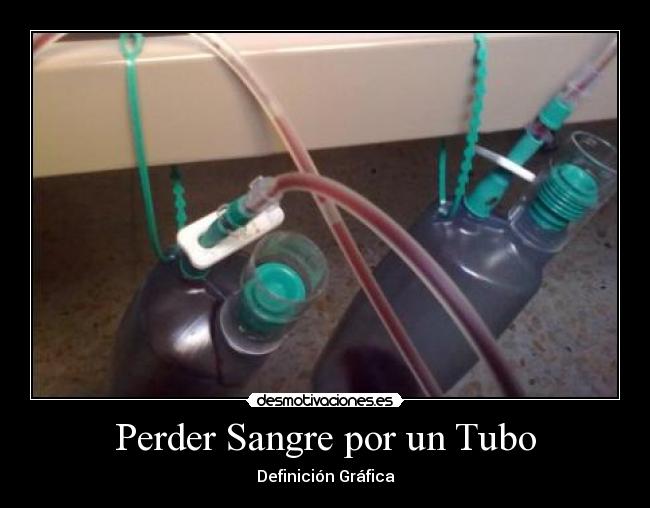 Perder Sangre por un Tubo -