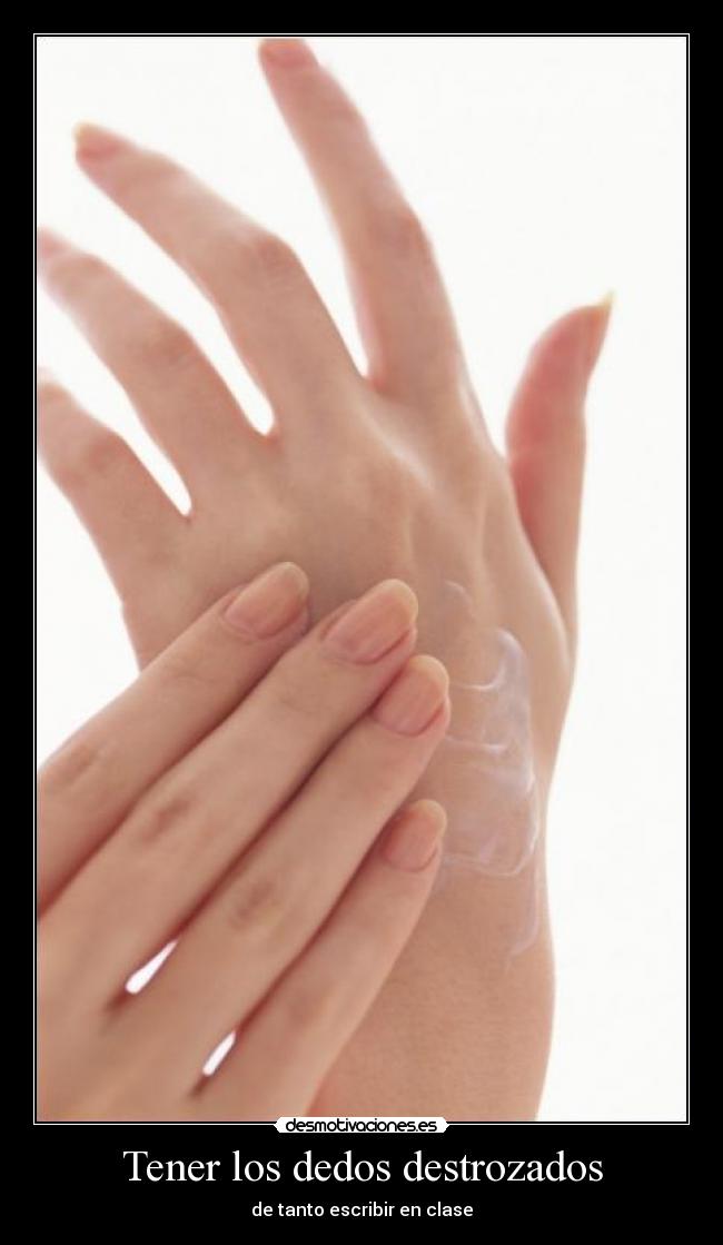 Tener los dedos destrozados - 
