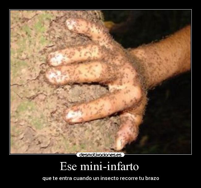 Ese mini-infarto -