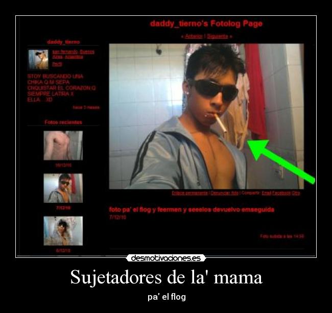 Sujetadores de la mama - 