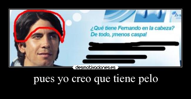 pues yo creo que tiene pelo - 