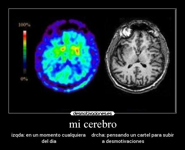 mi cerebro - izqda: en un momento cualquiera     drcha: pensando un cartel para subir
del dia                                        a desmotivaciones