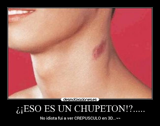 ¿¡ESO ES UN CHUPETON!?..... -