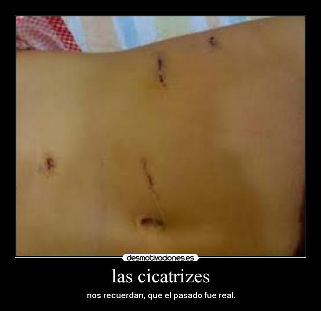 las cicatrizes - 