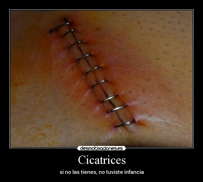 Cicatrices - 