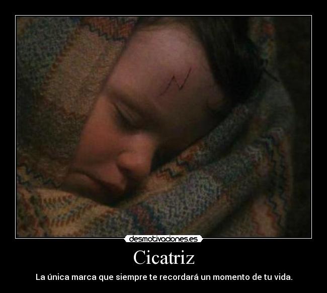 Cicatriz -