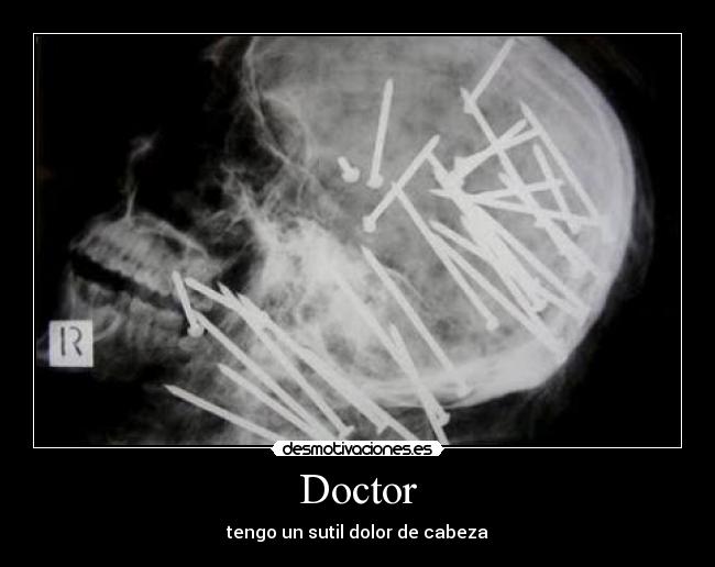 Doctor - tengo un sutil dolor de cabeza