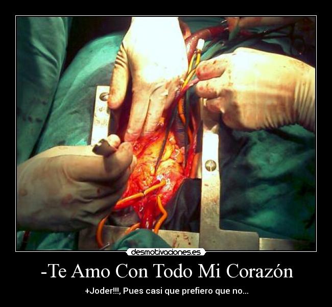-Te Amo Con Todo Mi Corazón - +Joder!!!, Pues casi que prefiero que no...