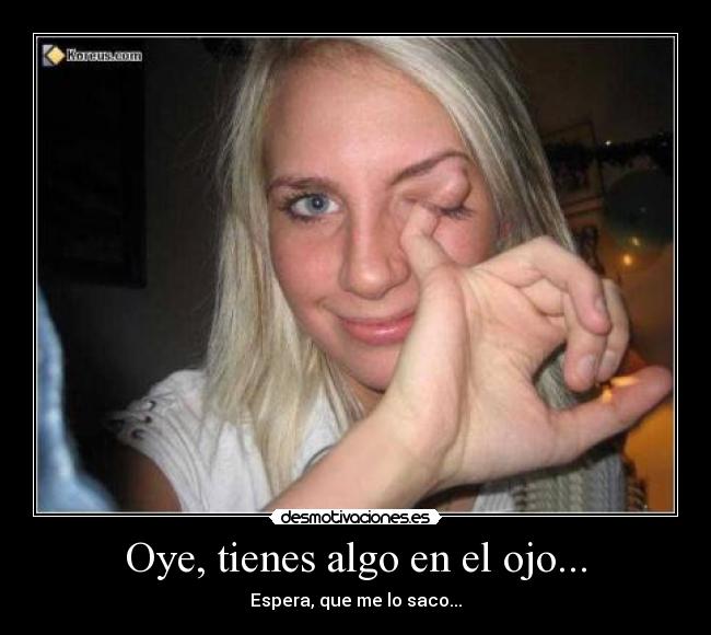 Oye, tienes algo en el ojo... - 