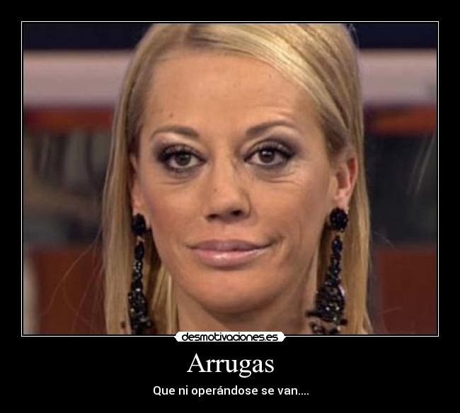 Arrugas - Que ni operándose se van....