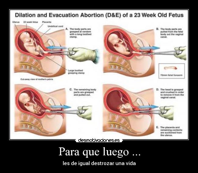 Para que luego ... - les de igual destrozar una vida