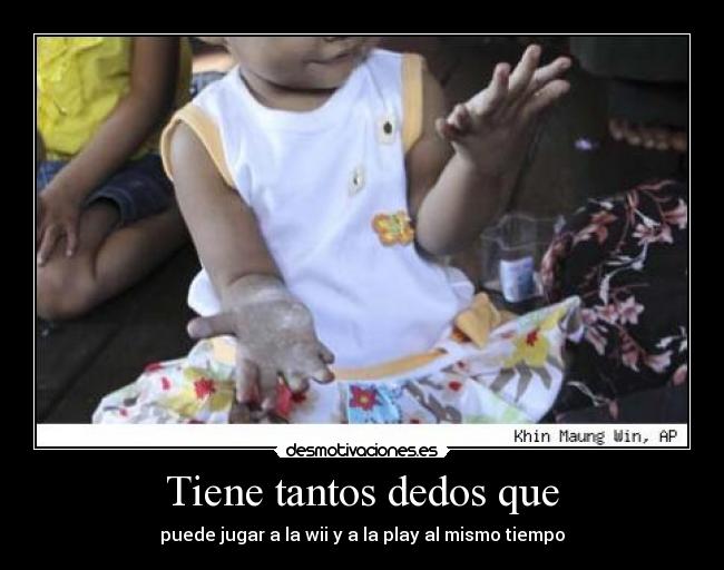 Tiene tantos dedos que -